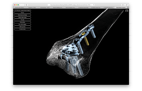 WebGL Interactive - Midface System